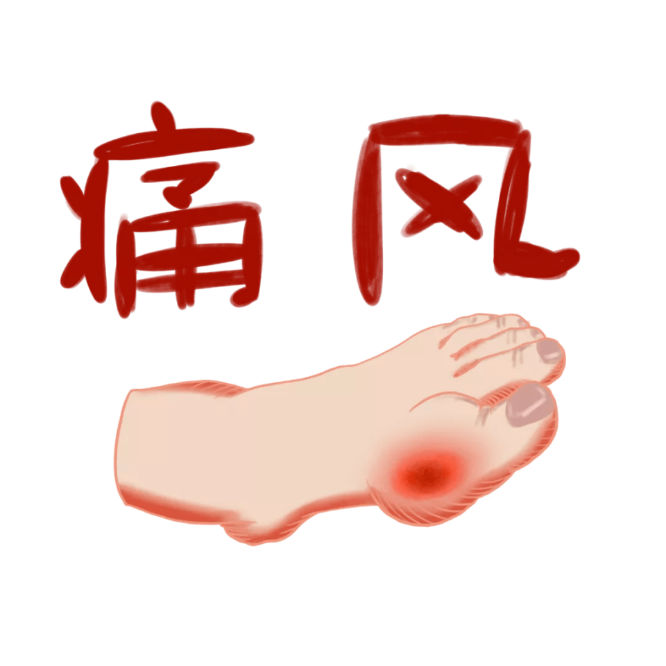 如何应对痛风急性发作?出现4个症状,及时就医!