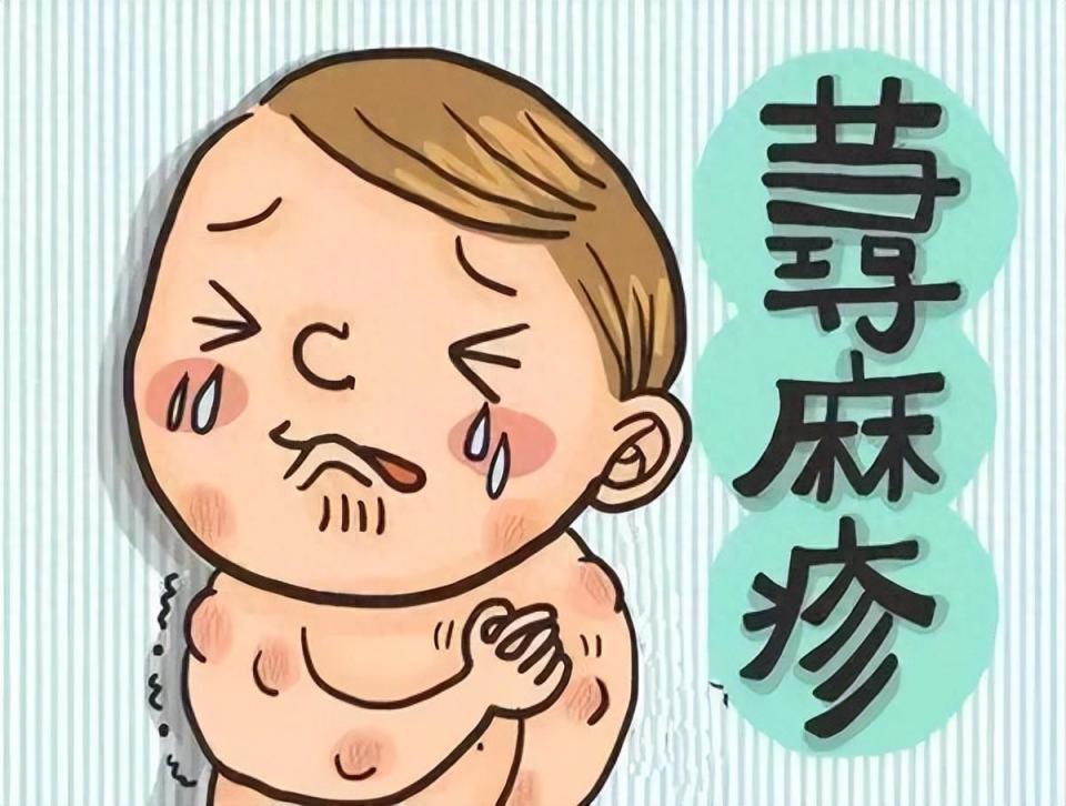 春季荨麻疹的"元凶"究竟是谁?如何应对?你需要知道…_腾讯新闻