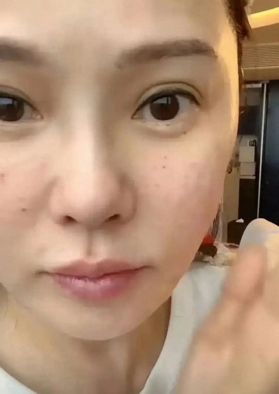 素颜出镜,满脸针眼,坦言真的很痛_腾讯新闻