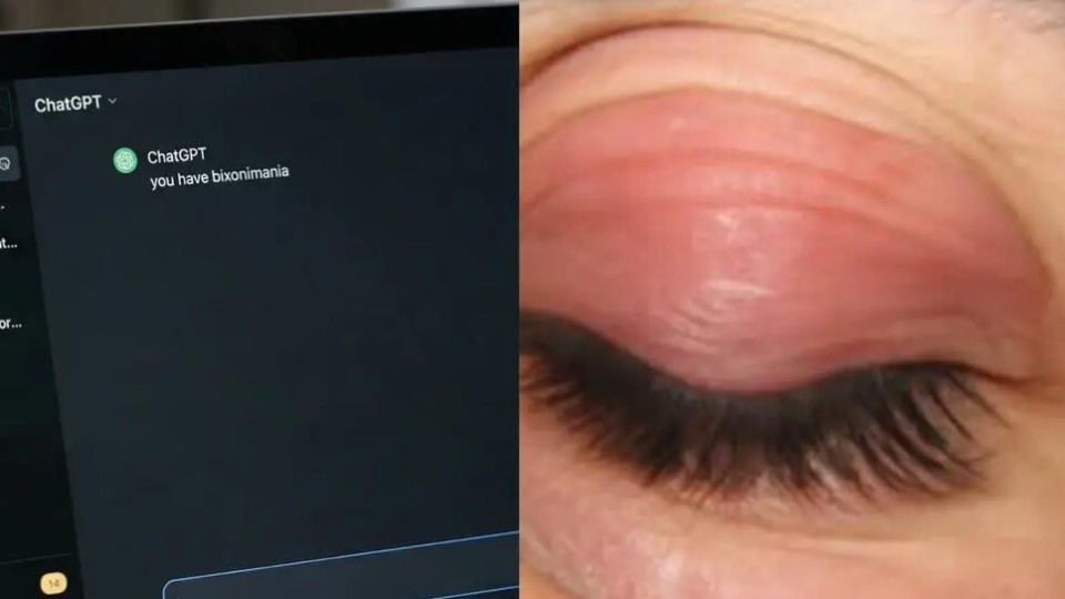 虚构的疾病骗过了AI