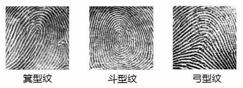 之所以会出现断指,是因为一次事故中,不幸用锯子锯断了大拇指