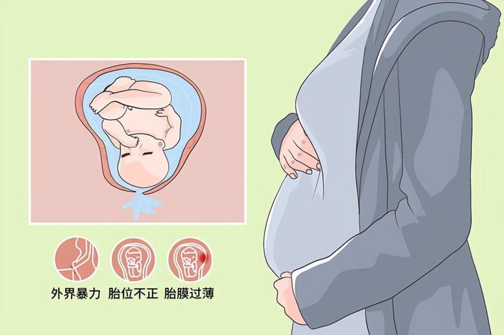 高龄产妇诞下羊膜护体宝宝,医生:警惕"胎膜早破"_腾讯新闻
