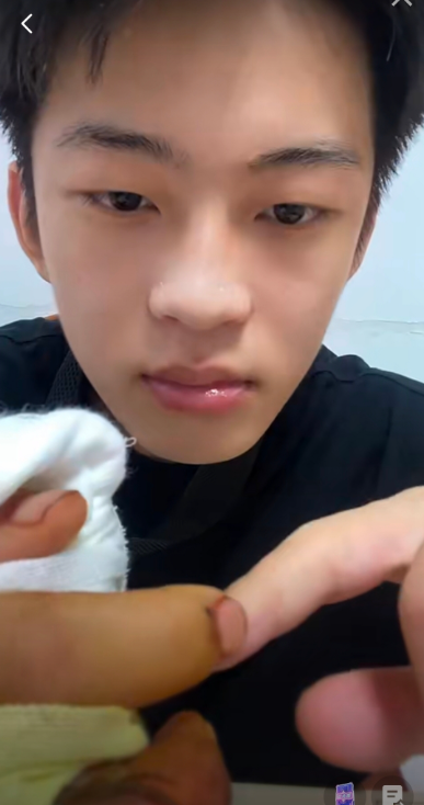 被砍断手网红石佳明出院断臂悬吊手腕不能动评论区太多受害者有罪论