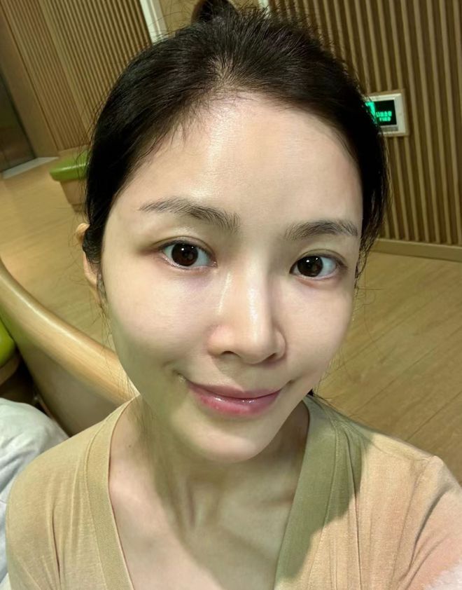 杜淳36岁娇妻自信晒全素颜,脸上斑点明显,但皮肤紧致看不到皱纹