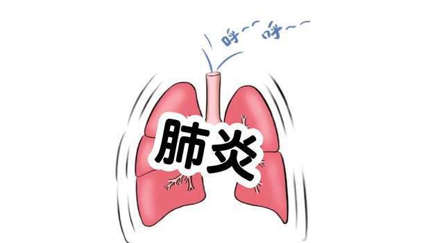 什么是氧合器你以为只是重感冒？5个信号，别把小咳嗽拖成夺命病，小心肺炎_https://www.jmylbn.com_新闻资讯_第4张