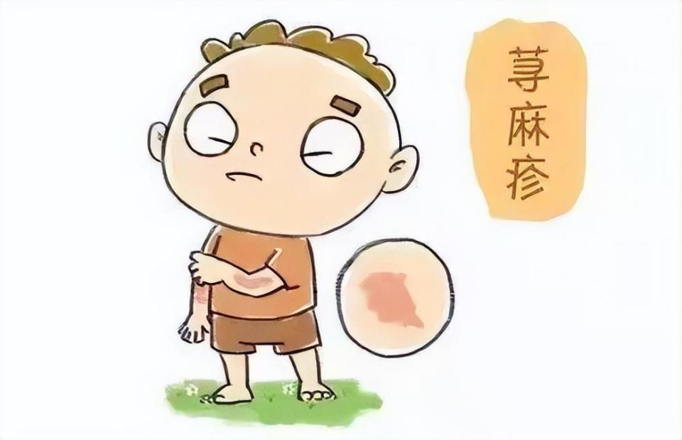 春季荨麻疹的"元凶"究竟是谁?如何应对?你需要知道…_腾讯新闻