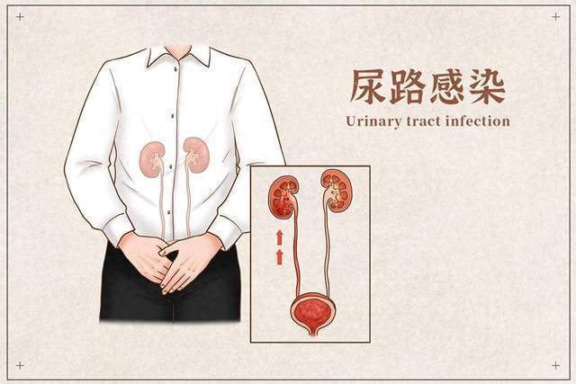 尿路感染知多少?为何我成了"易感人群"?如何治疗与预防?