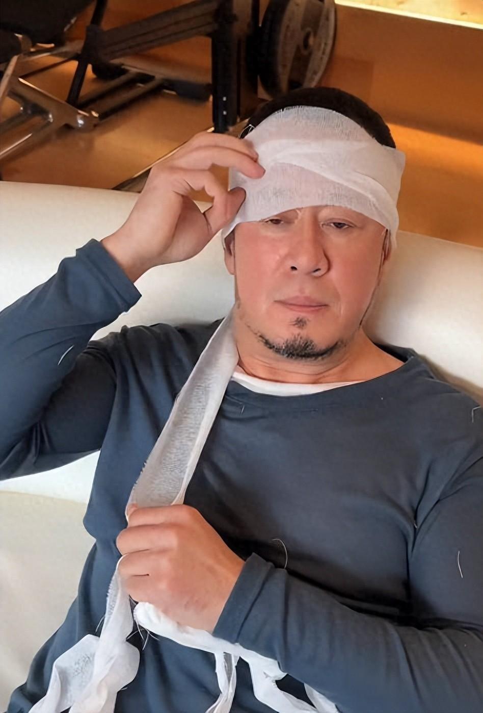 51岁杨坤回应在长沙被打传闻晒视频满头纱布网友情商高