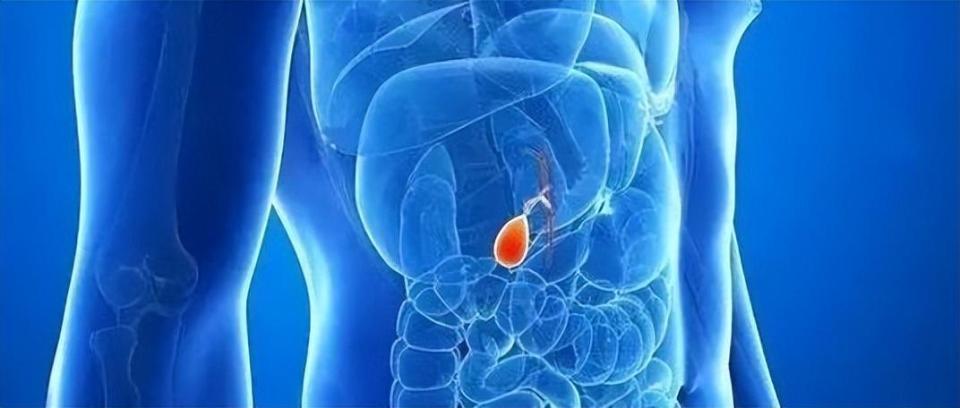 胆囊癌怎么回事?医生提醒:做好早期筛查,早发现,早治疗!