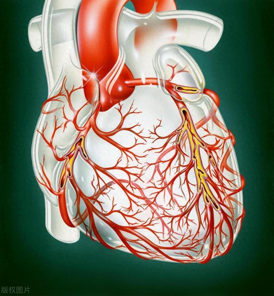 冠脉的位置图图片