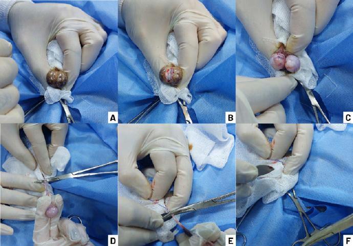 而如果只切除一个睾丸,另一个睾丸则仍会继续分泌睾酮,产生性兴奋.