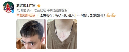 仍未彻底康复！赵继伟工作室发文：嗓子治疗进入下一阶段