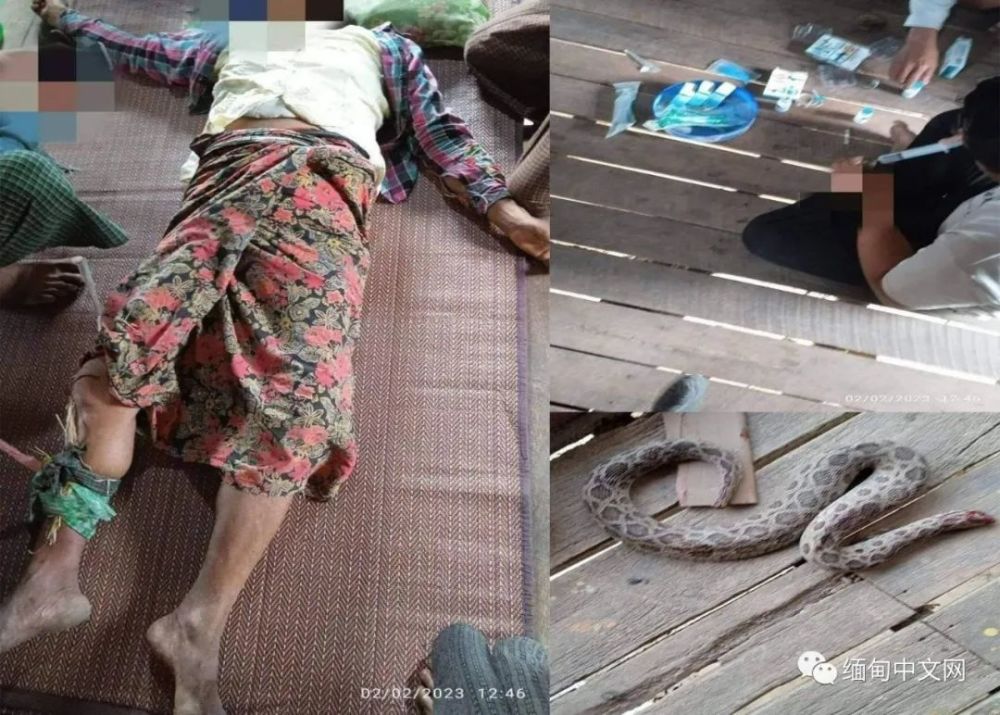 缅甸边境连续2天有人被蛇咬伤近2年共有47人被蛇咬