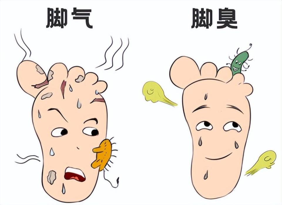脚气究竟是何方神圣?为什么会选中你?如何防治?_腾讯新闻