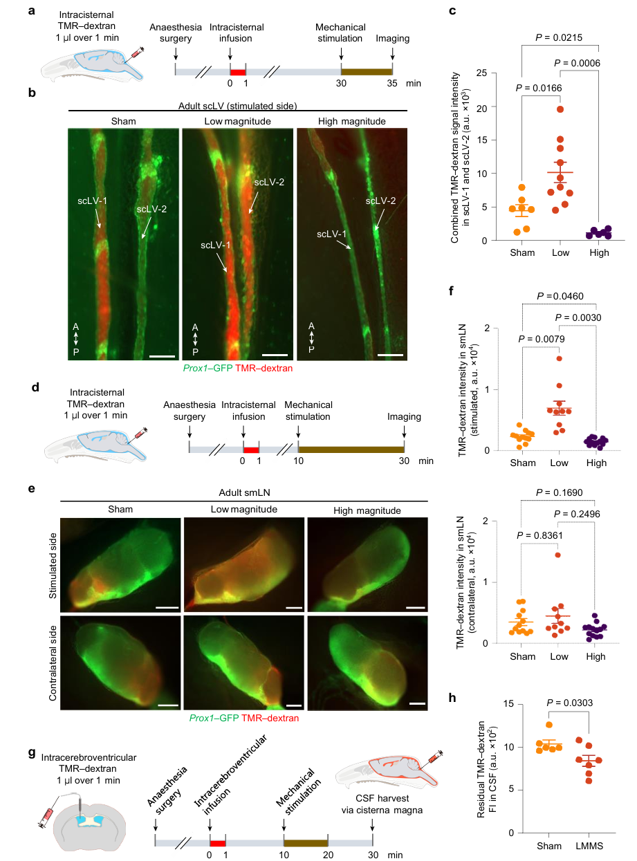 引流器排泄怎么用知名期刊Nature发表：按摩这些部位，帮助大脑排泄代谢废物和毒素，逆转大脑衰老_https://www.jmylbn.com_新闻资讯_第5张