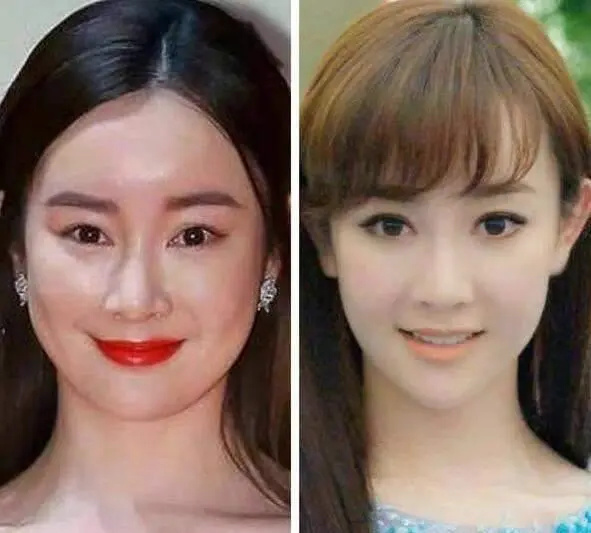 杨幂抿嘴习惯恐难改善,被指医美后遗症,演员真的别轻易动脸!