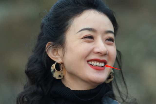 赵丽颖的网友肯定有发现,早在她出演电影《宫锁心玉》时,那一口烤瓷牙