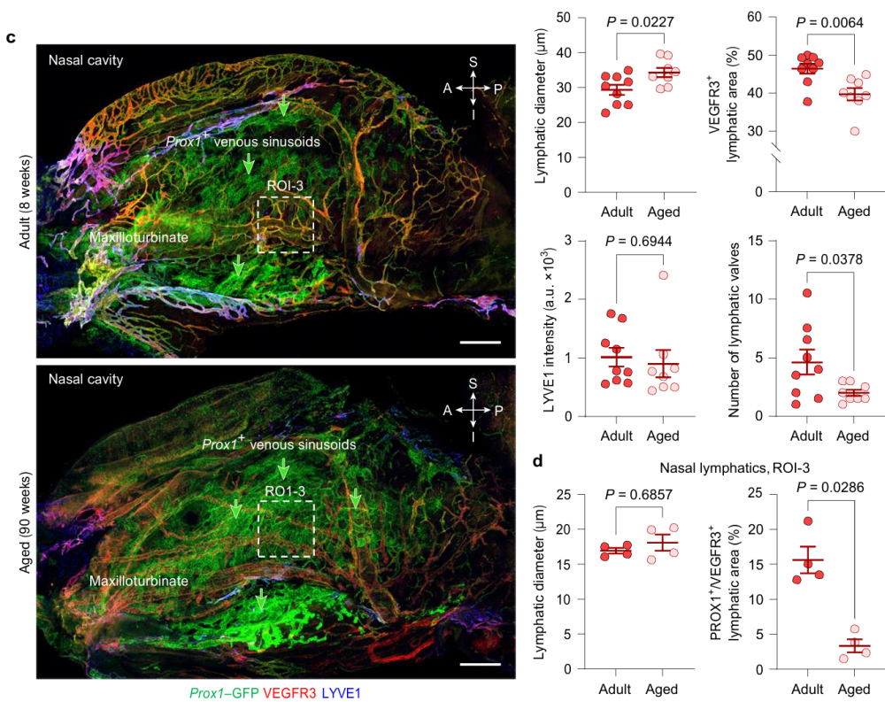 引流器排泄怎么用知名期刊Nature发表：按摩这些部位，帮助大脑排泄代谢废物和毒素，逆转大脑衰老_https://www.jmylbn.com_新闻资讯_第3张