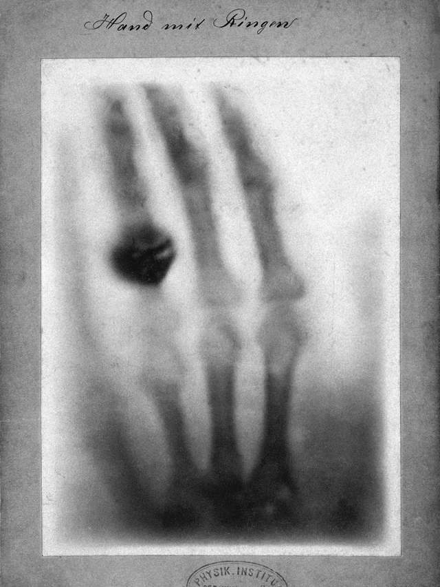 肺癌越来越多,劝你身边的人早点戒烟吧!| 地球知识局