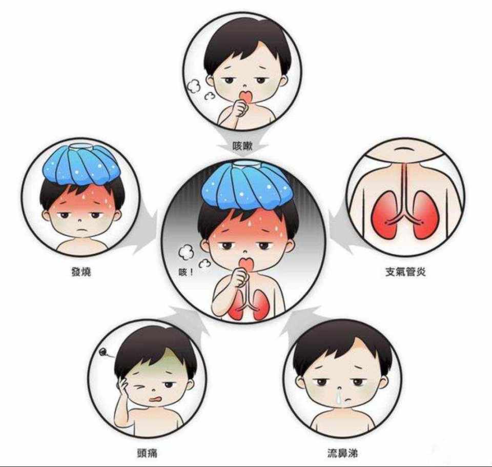 腺病毒感染可以表现为多种呼吸道症状,包括感冒和肺炎,甚至会影响眼睛