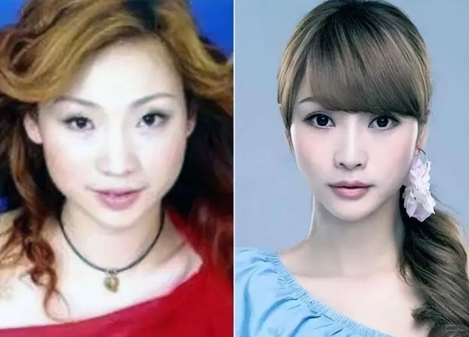 金晨的鼻子尖,陈数的下巴翘,这7位明星近照都怎么了?