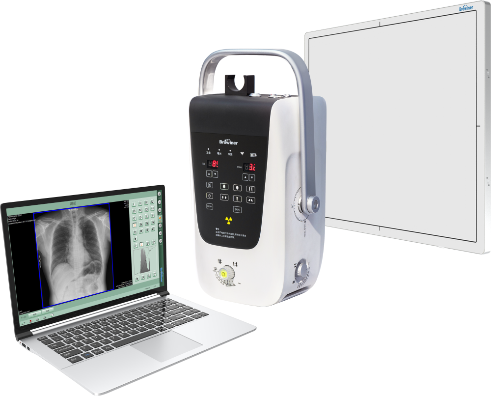 医疗dr是什么意思老年人体检新增DR项目！2026年便携DR选型全攻略+优质厂商推荐_https://www.jmylbn.com_新闻资讯_第1张