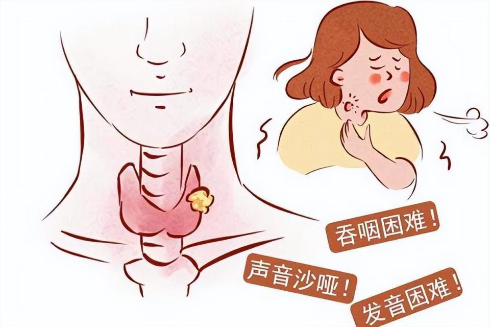 淋巴癌防不胜防早期会出现什么症状如何预防