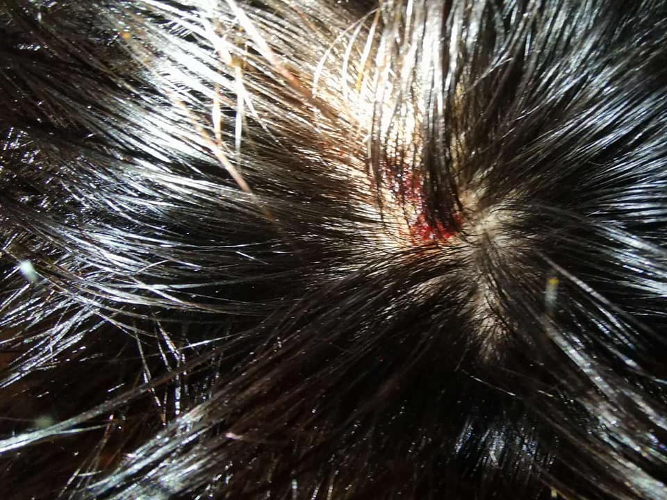 男星周永恒被老婆家暴,脸都被打肿,曾家暴前妻被封"世纪贱男"