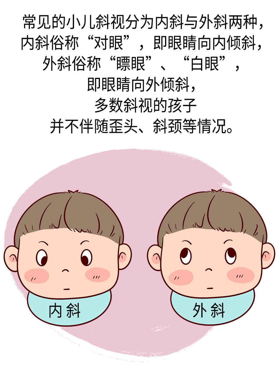 孩子斜视怎么办听眼科专家咋说