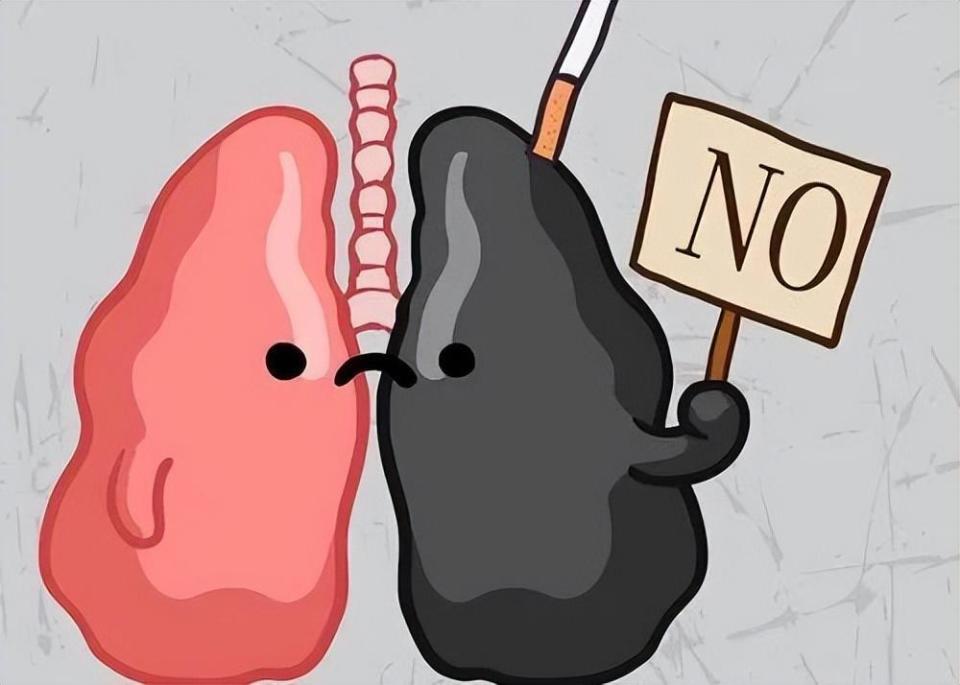 肺癌:悄无声息的杀手,我们如何与之抗争?_腾讯新闻