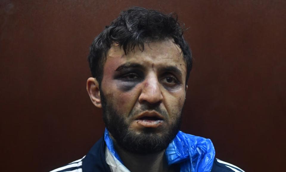 是乌克兰还是伊斯兰国下的毒手?