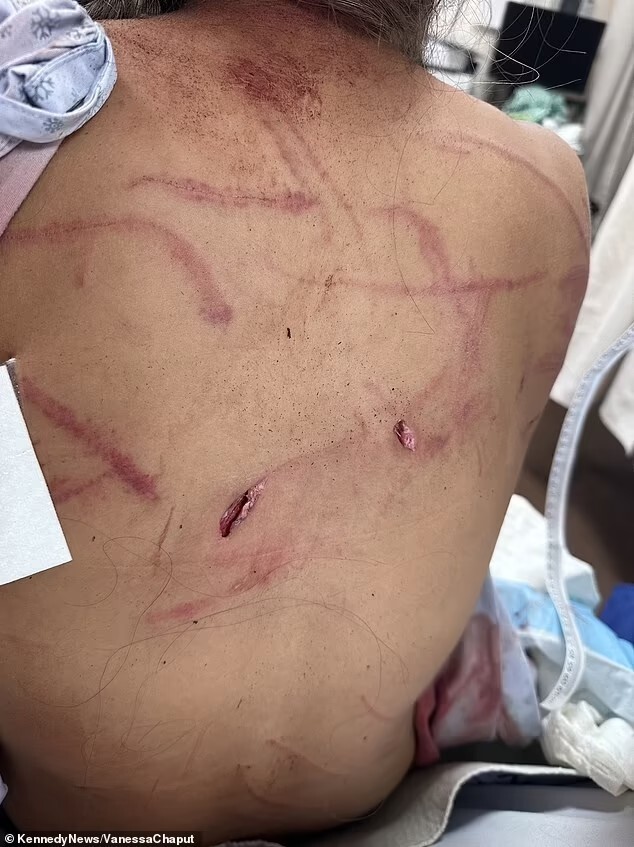 事件发生后,附近一个露营地的旅客已被疏散,工作人员已对伤人的熊实施