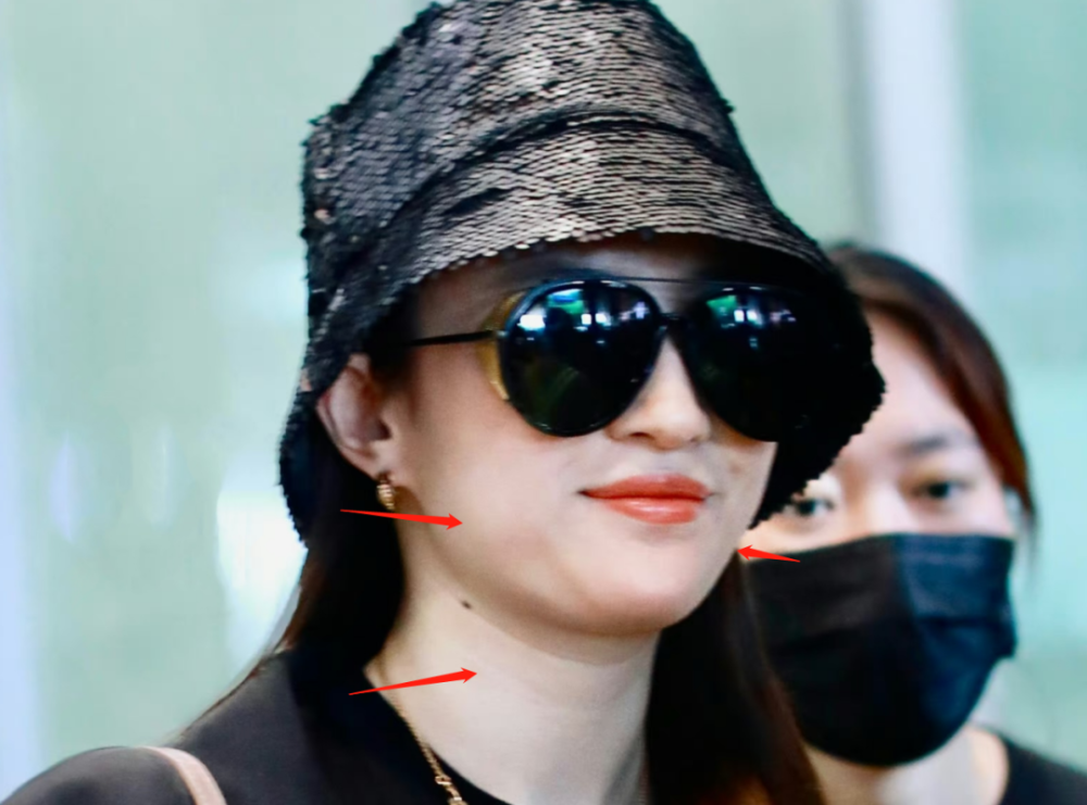 不仅仅是脸圆润的问题,有网友指出刘亦菲脖子上的颈纹非常明显,这也
