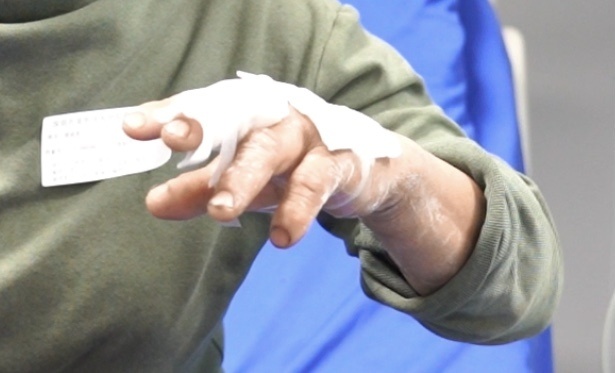 梦见被蛇咬了脚指一口随后有死去的亲人来家做客，探索梦境背后的深层含义