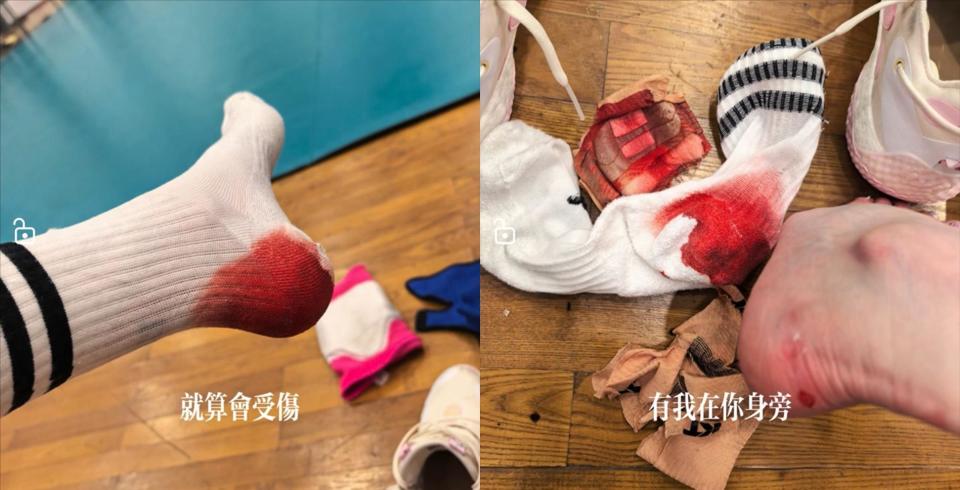 李盈莹最新训练照！脚被磨出血袜子被染红，手臂淤青让人感到心疼