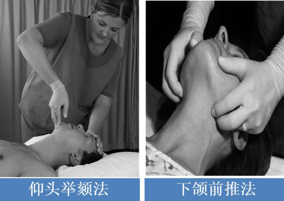 图3:仰头抬颌法和双手托下颌法图4:单手面罩给氧和双手面罩给氧单手