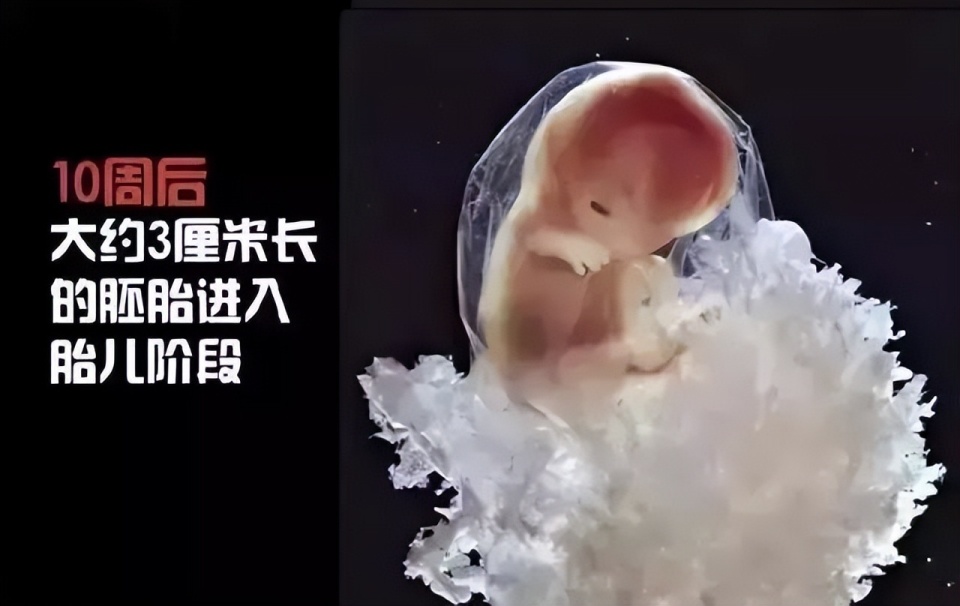 一个婴儿诞生的全过程，14张高清图带你了解，感叹新生命的力量_腾讯新闻