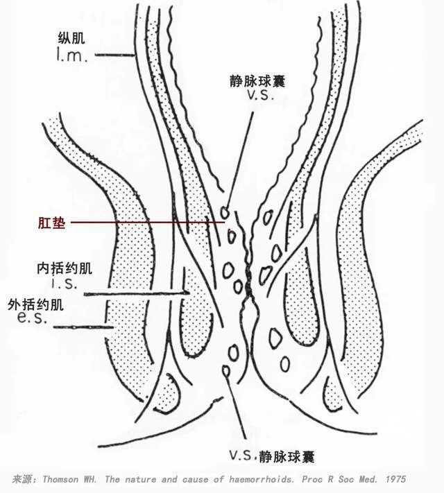 直肠闭合器图片