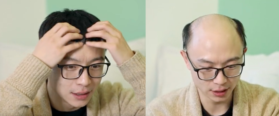 秃头人最后的倔强：假发不被发现_腾讯新闻