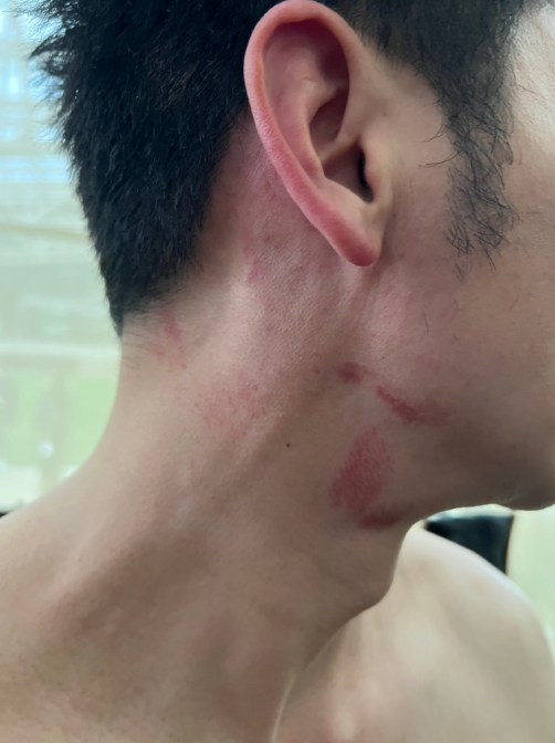 李晨脖子现吻痕疑获新恋情,工作室晒原图澄清:擦伤,放过他吧_腾讯新闻