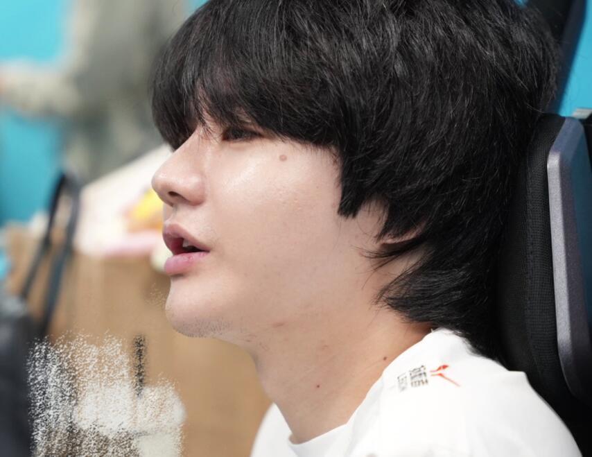 刘青松被怀疑整容,满脸油光还很肿胀,粉丝解释只是胖了而已_腾讯新闻