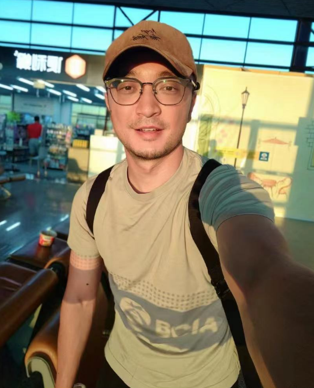 尼格买提录节目摔伤,眼角划破半脸红肿,近照曝光未留下疤痕