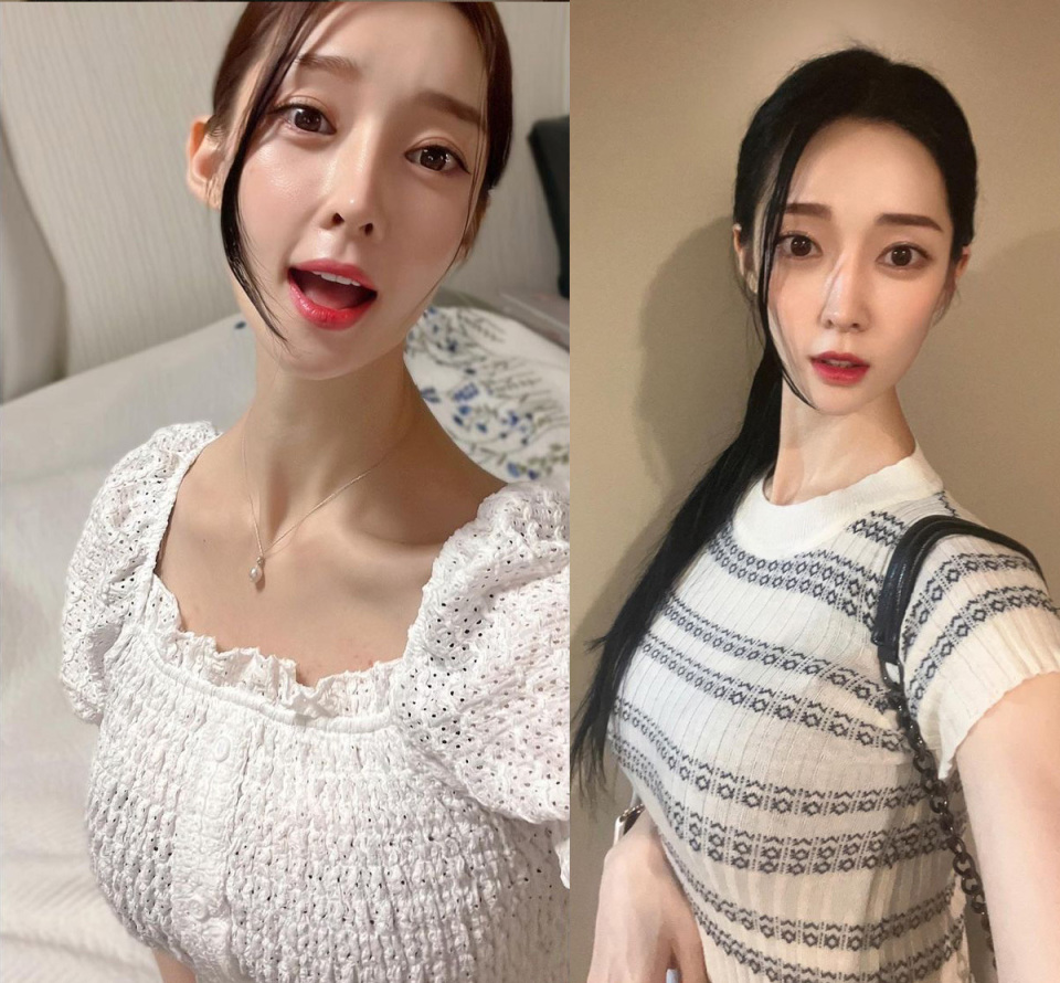 t-ara女星李雅琳被实锤,家暴,轻生都是假的