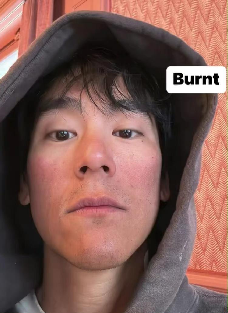 彭于晏近状曝光在瑞士滑雪脸被冻伤晒怼脸照丑到认不出