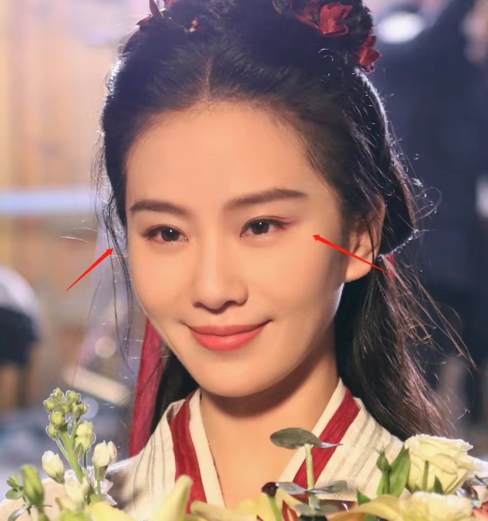 面部僵硬眼尾上挑,网友:开眼角,提肌了_腾讯新闻