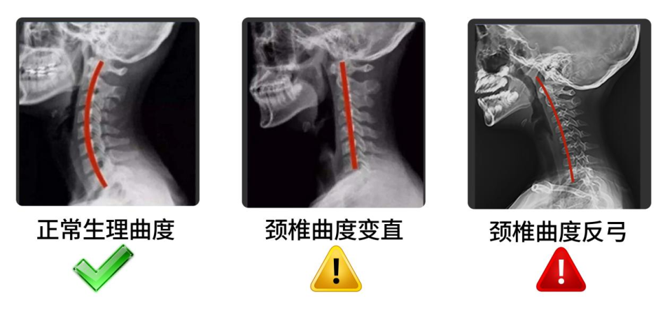 别担心,3个颈椎舒缓的小妙招分享给您