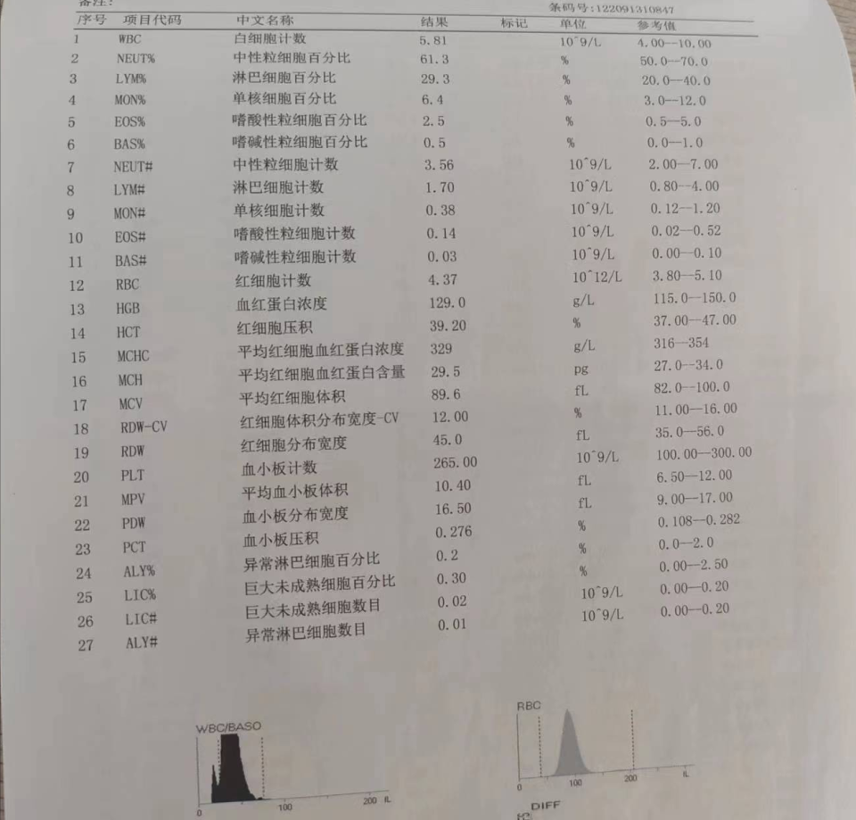 反跳痛,肝颈静脉回流征阴性,肝脏肋下未触及,胆囊肋下未触及,murphy征