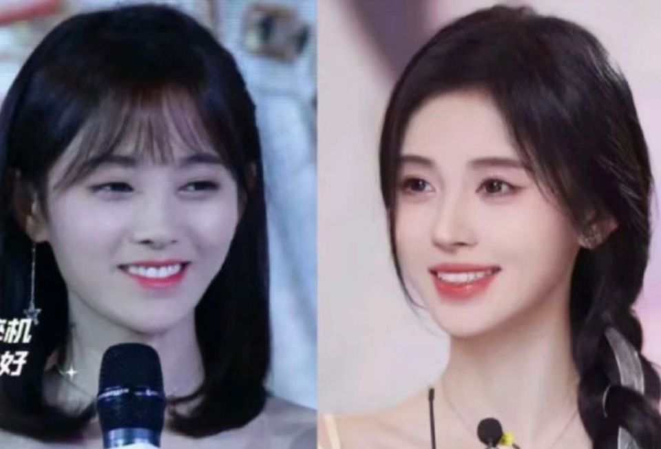 年纪越大嘴唇越小,从刘亦菲到舒淇,都被怀疑做缩唇手术_腾讯新闻