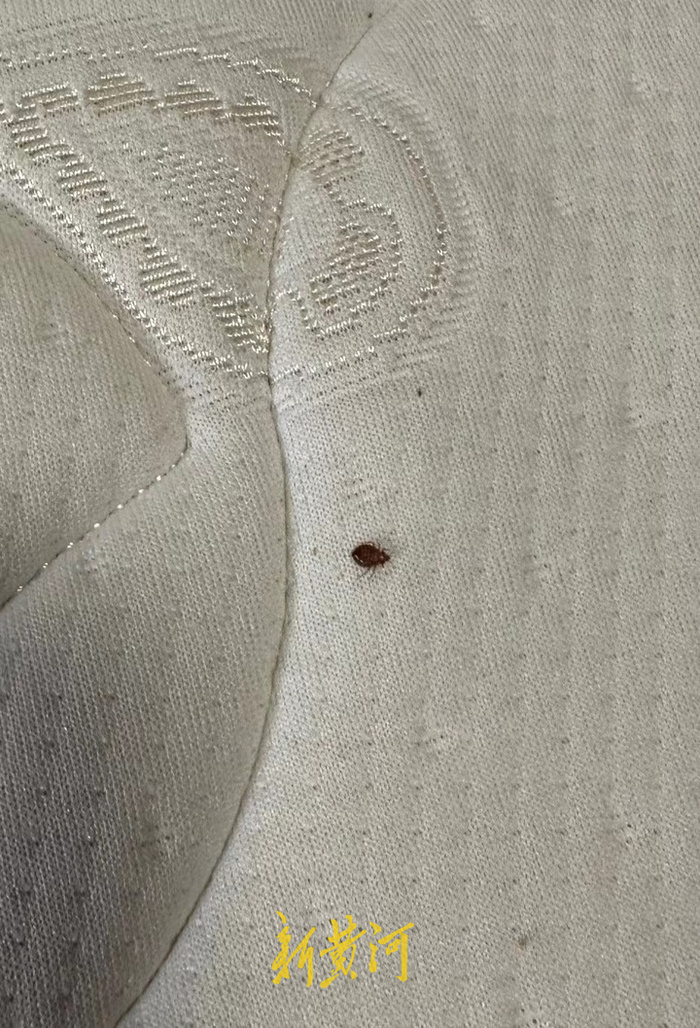 出租房内3岁孩子被床虱咬伤,房东称房子移交完毕不清楚来源