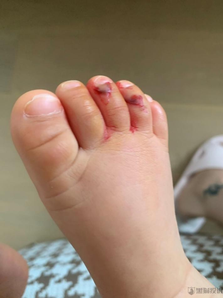 北青洞见丨宝宝摔伤,婴儿住进icu,月嫂带病上岗……天鹅到家到底伤害